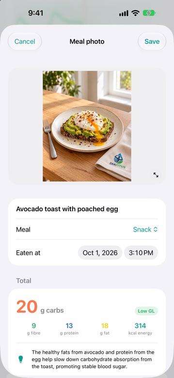 DiaFitus AI meal scan result for avocado toast with poached egg: 20 g carbs, 9 g fibre, 13 g protein, 18 g fat, 314 kcal